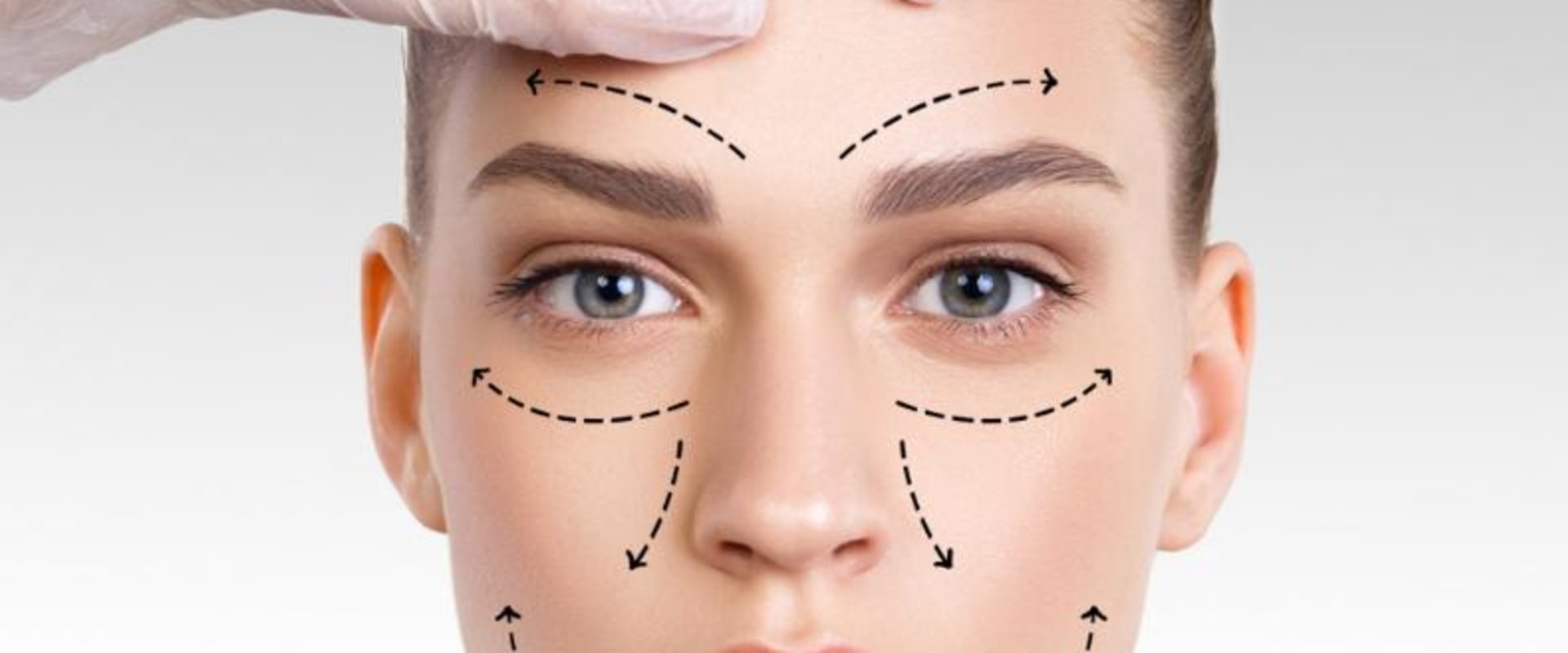 The Ultimate Guide to Facelifts